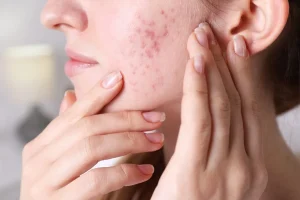 Gut Check: What Your Skin Says About Your Digestion
