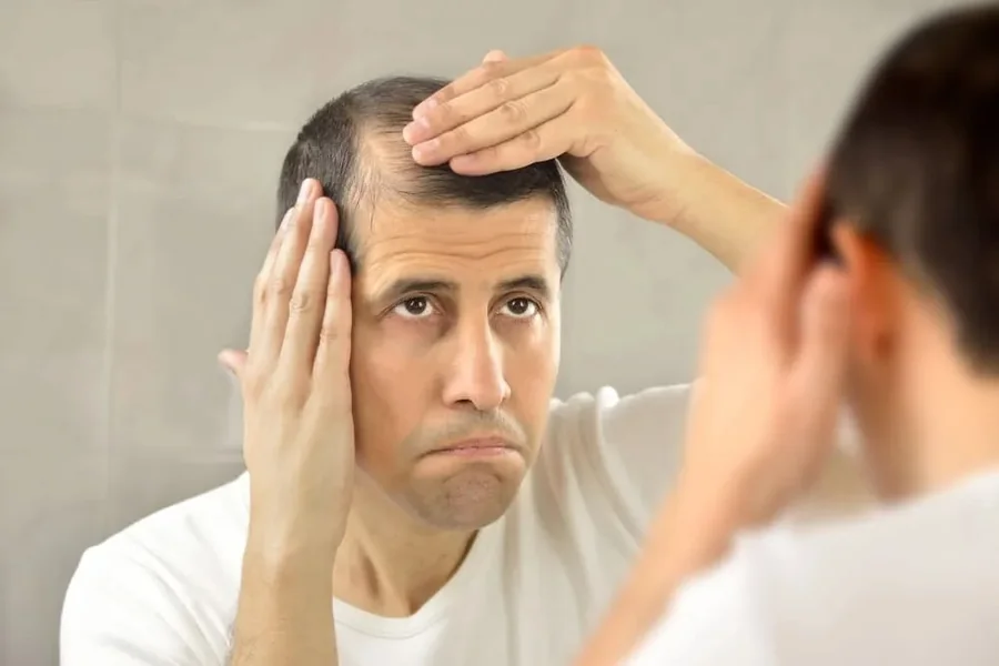 Understanding Hair Loss and Your Options