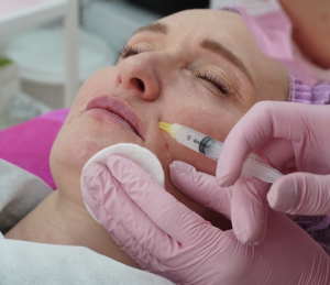 How Botox Can Boost Your Confidence in Minutes