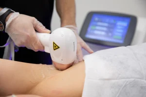 When Laser Hair Removal Is Better Than Electrolysis