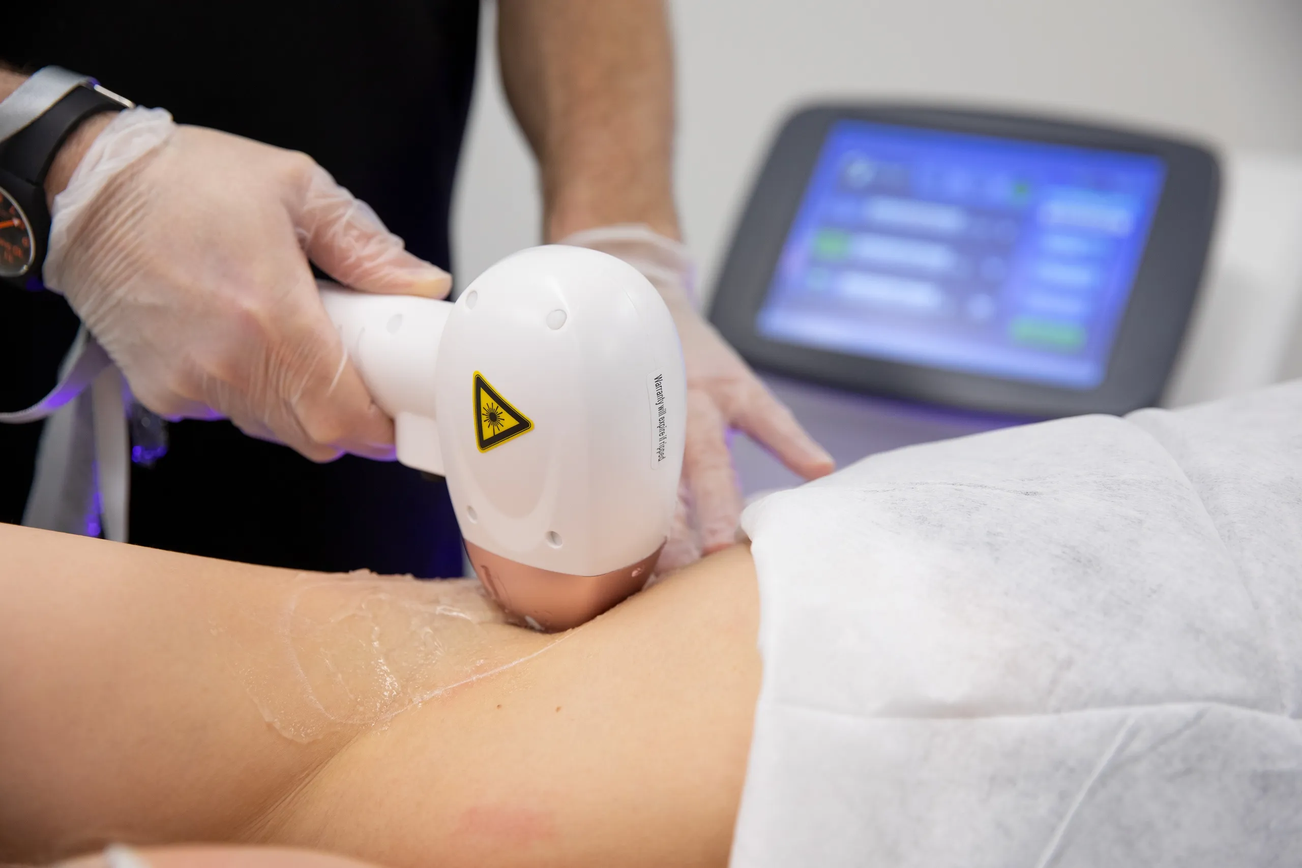 Laser Hair Removal