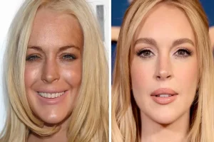Lindsay Lohan Plastic Surgery Talk And What Fans Notice