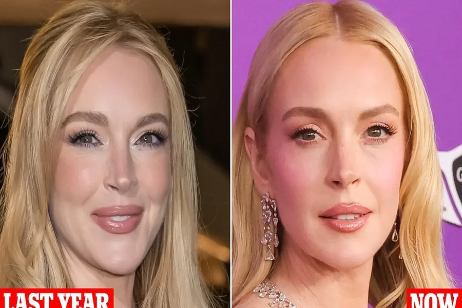 Lindsay Lohan Plastic