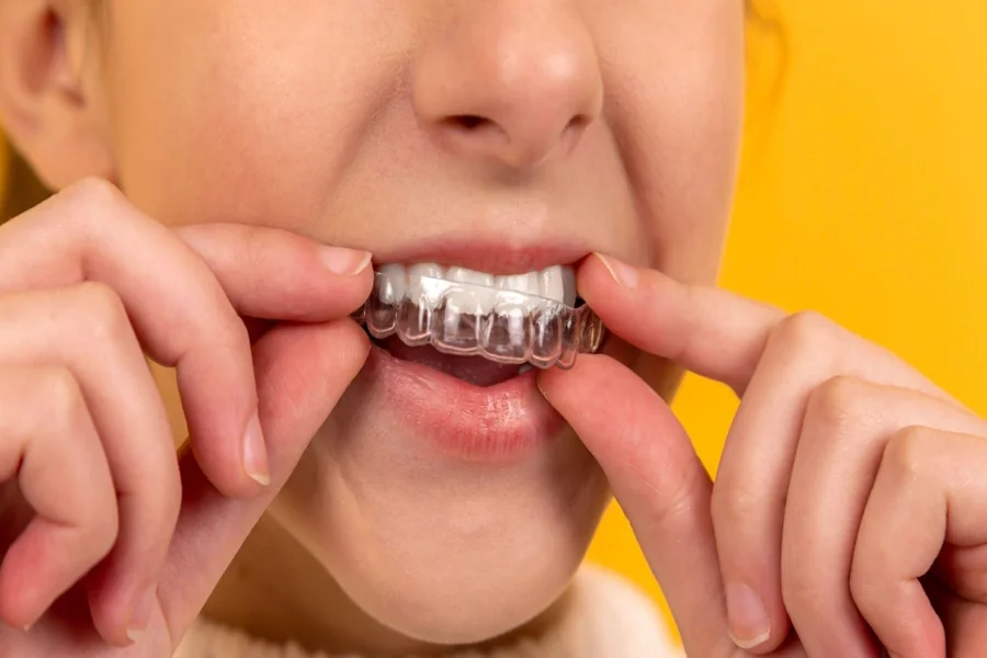 What are the Best Braces Options for Adults