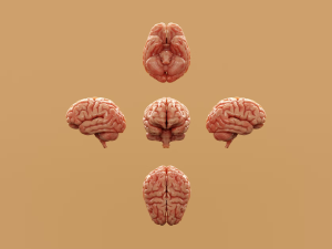 The Use of Neuroimaging in the Study of Mental Disorders