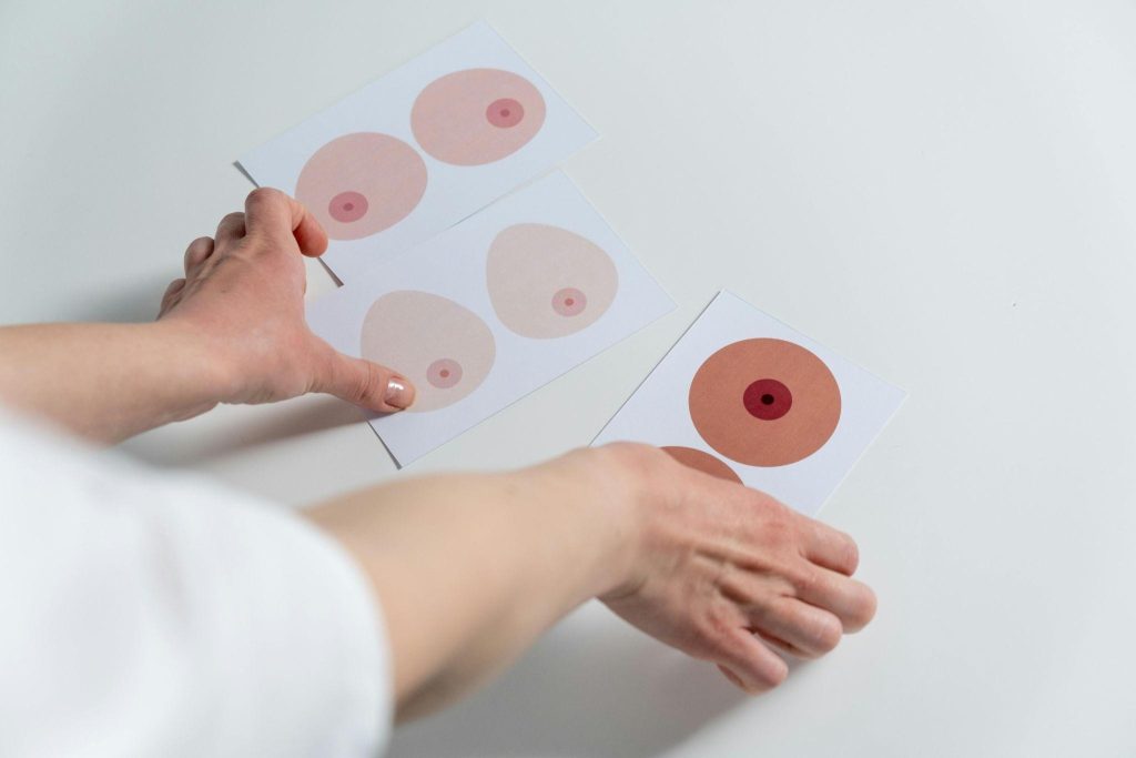Breast Augmentation