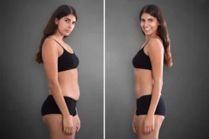 What Tirzepatide Weight Loss Can Mean For Long-Term Change
